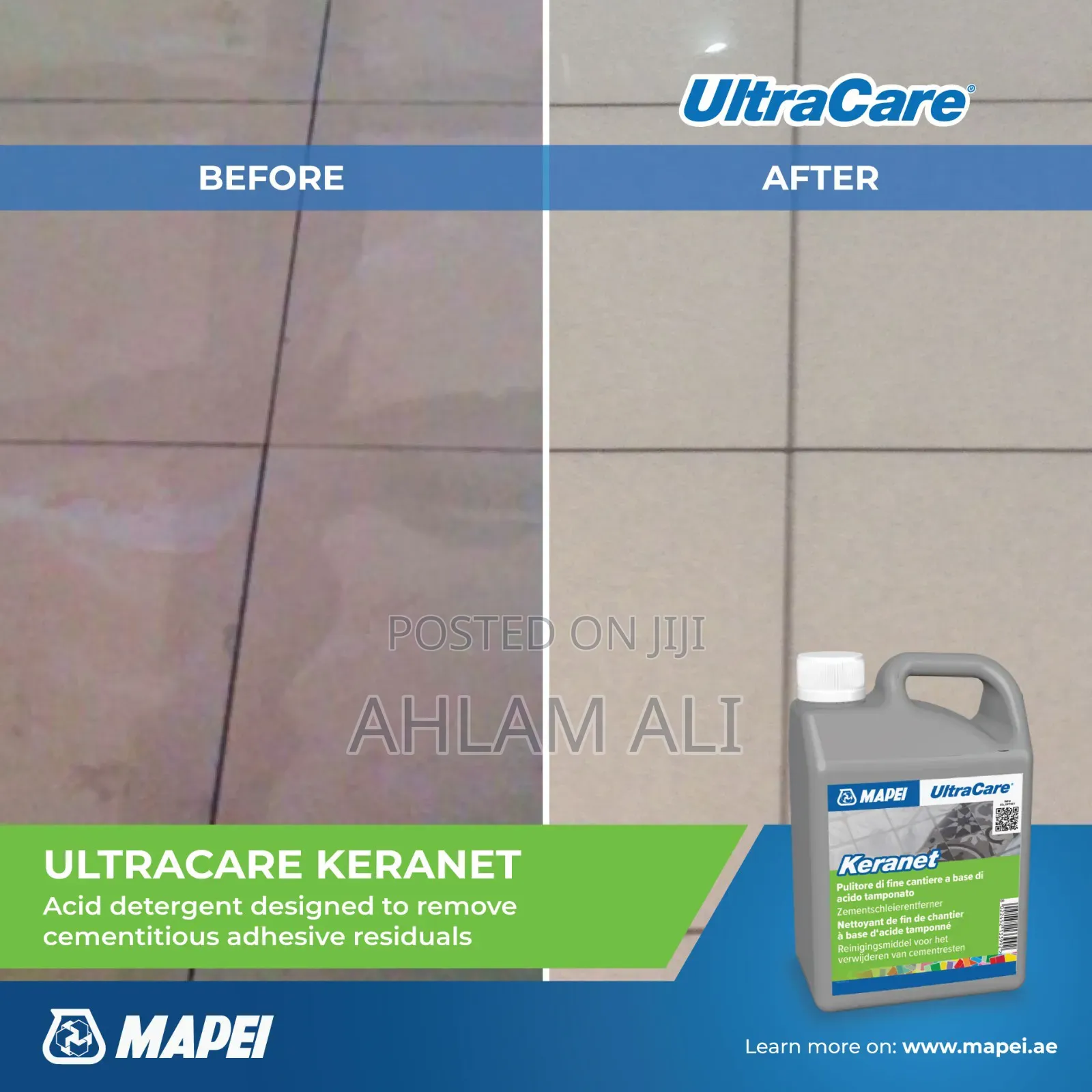Ultracare Keranet