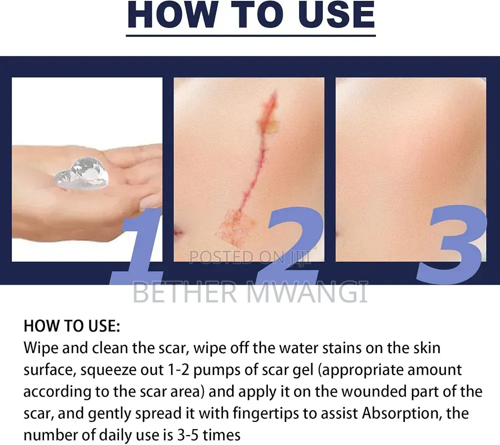 Advanced Silicone Scar Gel in Kenya