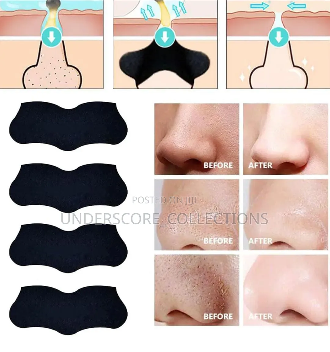 Blackhead Nose Strips