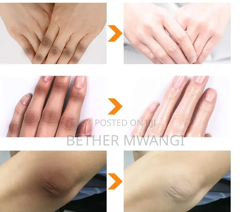 O'Carly Body Whitening Peeling Lotion in Kenya