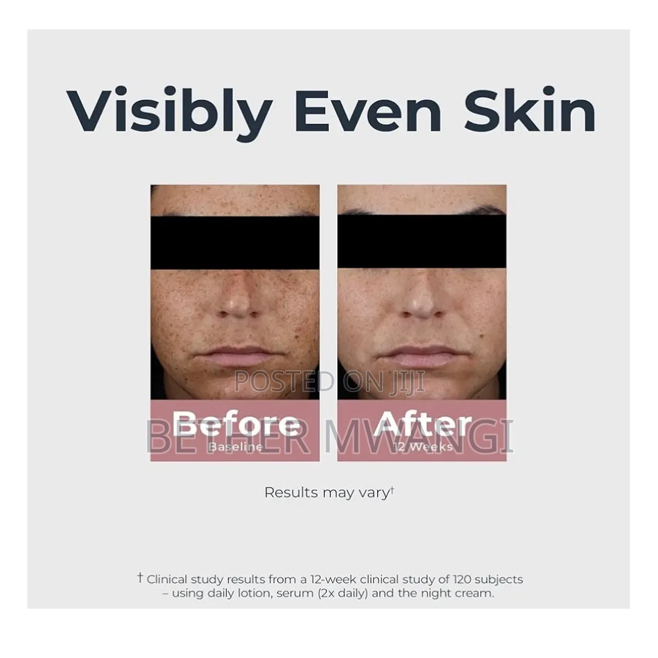 Eucerin Radiant Tone Dual Serum in Kenya
