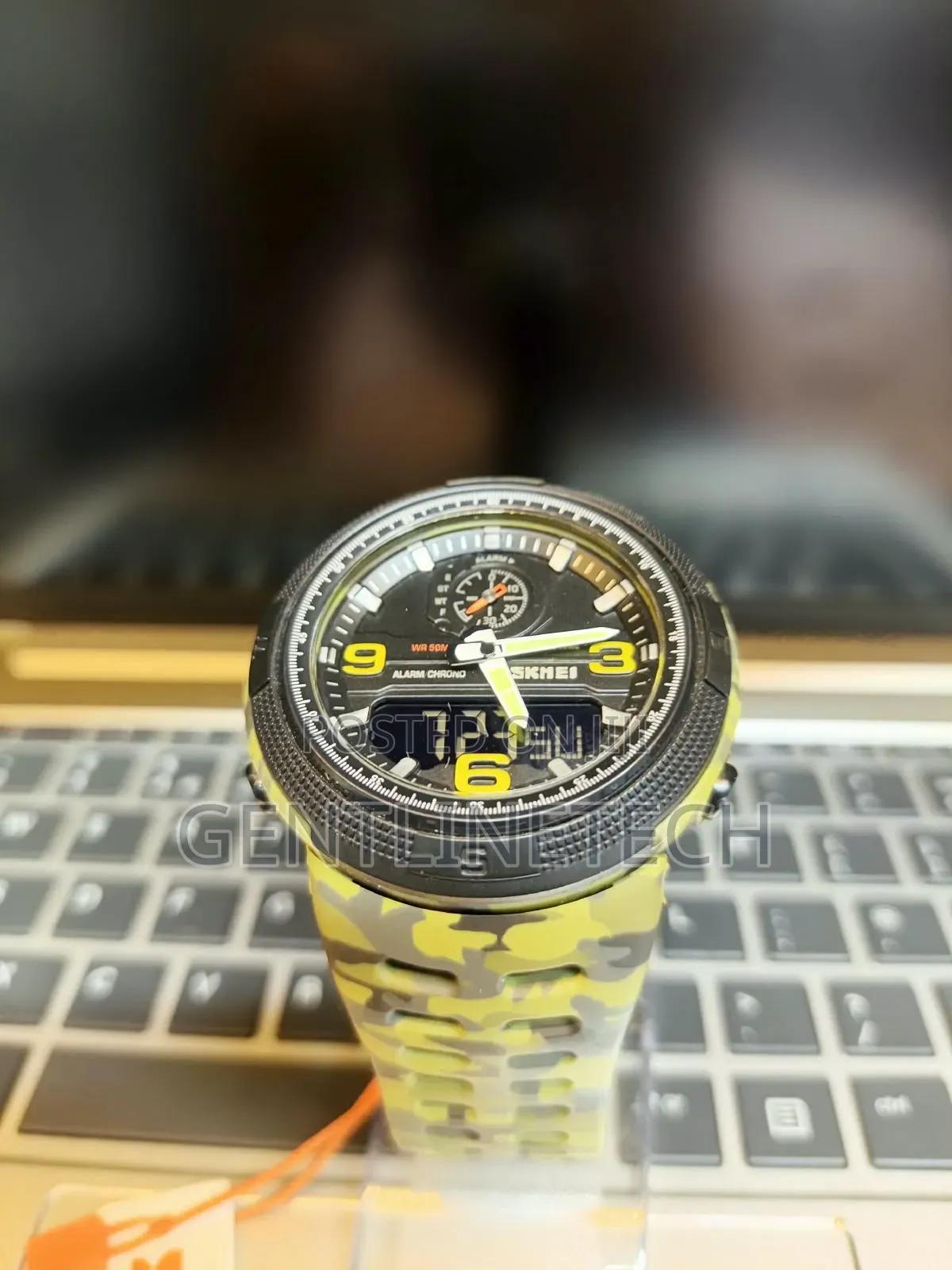 SKMEI 1555 Digital Sports Watch – KSh 2,500